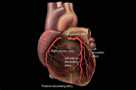 Coronary Arteries and Heart Disease