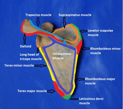 Infraglenoid Tubercle Of Scapula