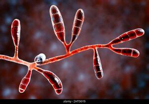 Epidermophyton floccosum - microbewiki