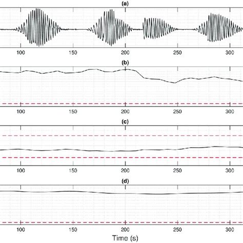 Patient with periodic breathing preceding Cheyne-Stokes respiration (a)... | Download Scientific ...