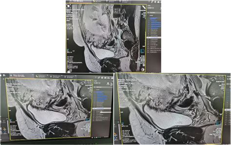 Ultrasound scans and MRT of patient. | Download Scientific Diagram