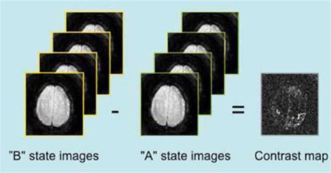 Analysis and interpretation of neuroimaging data Flashcards | Quizlet