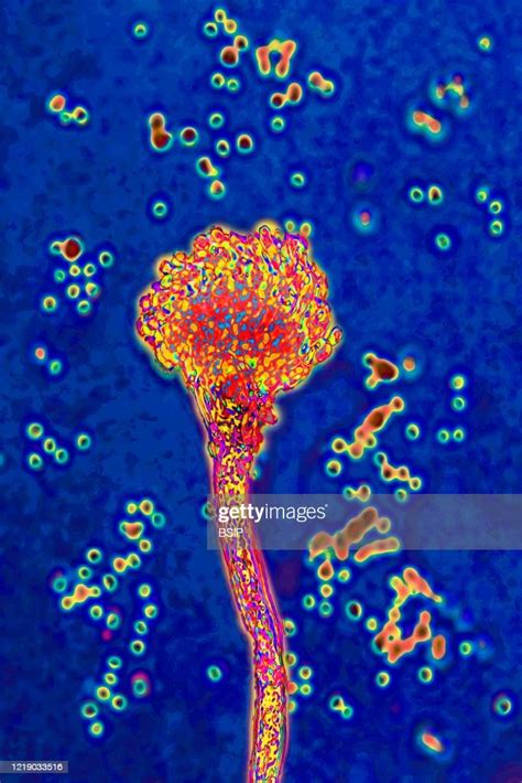 Aspergillus fumigatus, fungus responsible for severe infections as... News Photo - Getty Images