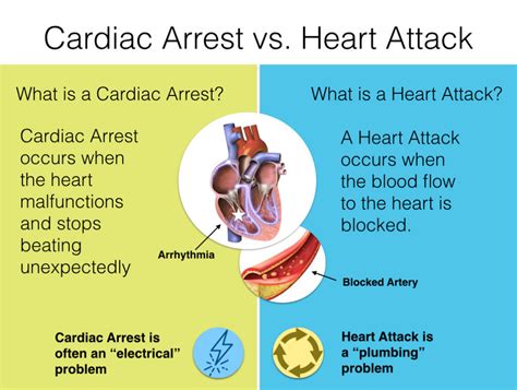 Paging Doctor T - Cardiac-arrest