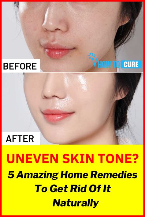 Naturally Red Skin Tone