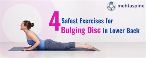 4 Safest Exercises for Bulging Disc in Lower Back