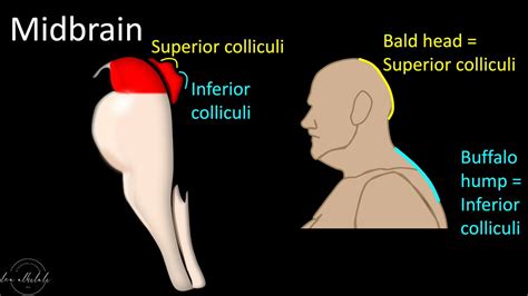 1/Do questions about brainstem anatomy cause you to suddenly get a case of locked in syndrome ...