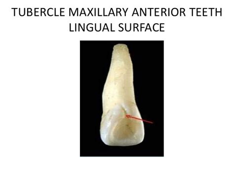 Anatomical structures of teeth