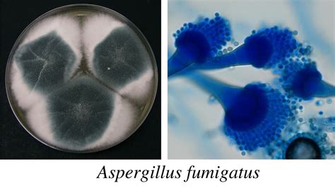 Aspergillus: Morphology, Clinical Features, and Lab Diagnosis • Microbe Online