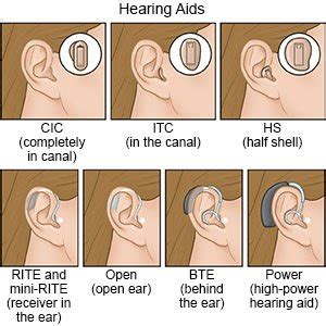 How to Choose A Hearing Aid - What You Need to Know