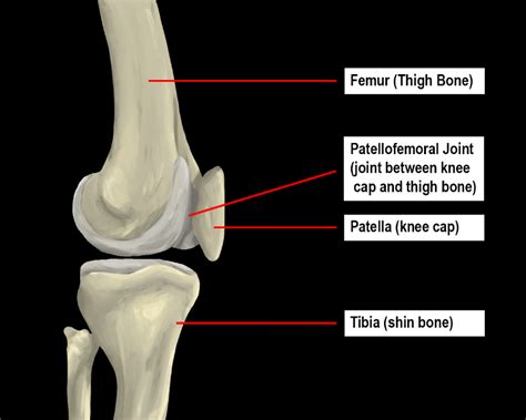 Patellofemoral Pain Syndrome Pfpscausessymptoms