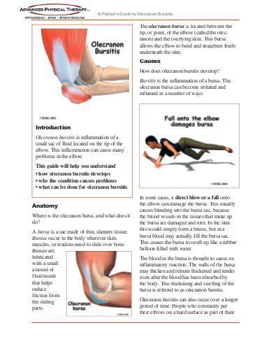 Olecranon Bursitis - Advanced Physical Therapy | Bursitis, Olecranon bursitis, Physical therapy