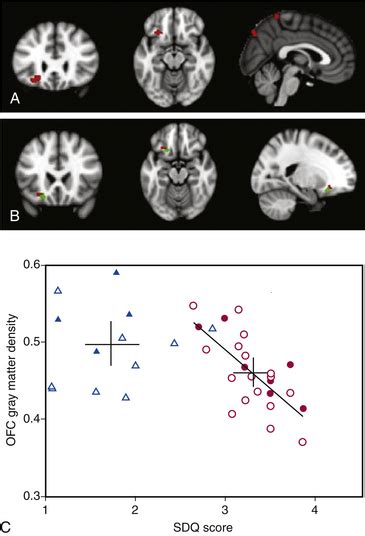 Neuroimaging Techniques | Neupsy Key