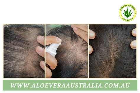 How to get thicker hair - Aloe Vera Australia