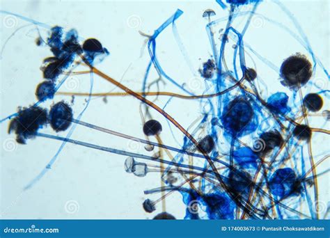 Rhizopus Bread Mold Under the Microscope Stock Image - Image of fumigatus, enzyme: 174003673