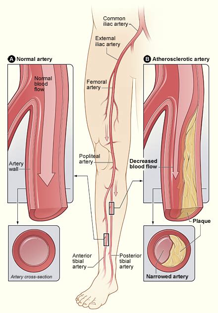 Vascular & Endovascular Surgery - Angiography