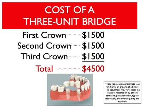 Cost Difference Between Dental Bridge and Dental Implant | Cost Difference Between Dental Bridge ...