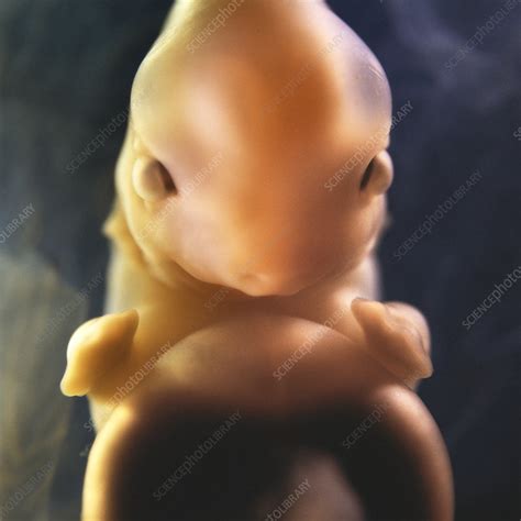 Pig embryo - Stock Image - C048/9348 - Science Photo Library