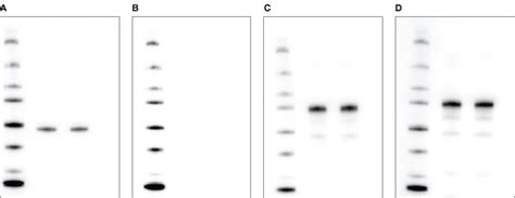 Western Blot Stripping Buffer Recipe Pvdf | Besto Blog