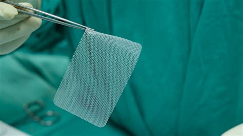 Understanding the Risks of Hernia Mesh