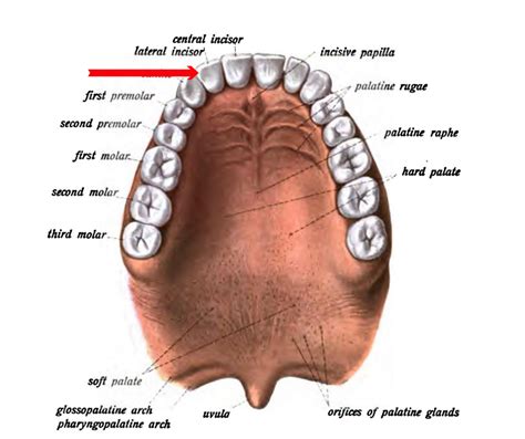 A Missing Lateral Incisor, A Gap-Toothed Smile & The Tooth Fairy - Michael Sinkin, DDS MAGD