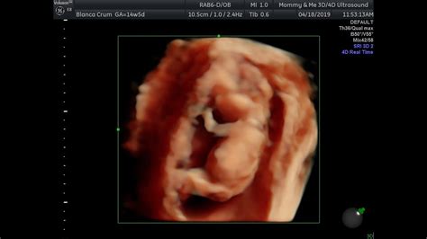 13 Week Gender 4d Ultrasound