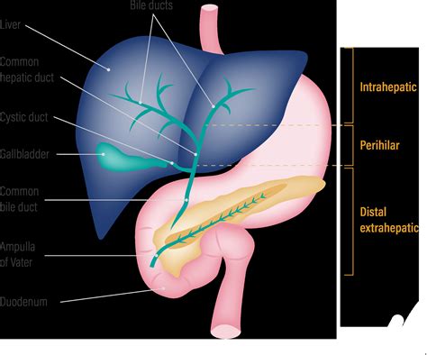 Gallbladder Pain Diagram - diagram visual paradigm