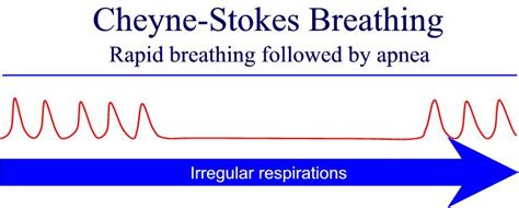 What is Cheyne-Stokes respiration? – First aid for free