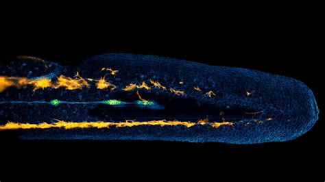 Lateral line cells and melanocytes migrating in a zebrafish embryo | Nikon Small World