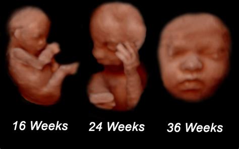 Best Time Frame For 3d Ultrasound - Get More Anythink's