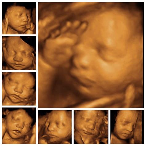 Cherished Memories 3D/4D Ultrasound - 40 Photos - Ultrasound Imaging Centers - 520 Hwy 9 ...