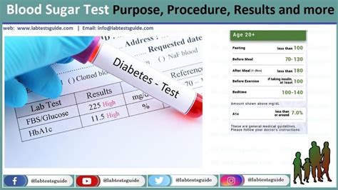 Sugar Test Method | Lab Tests Guide