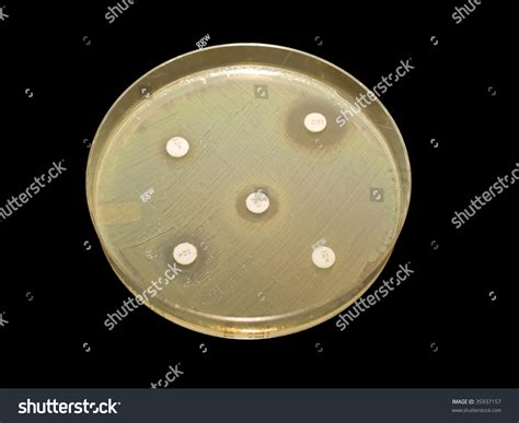 Bacteria Growing On Petri Dish Showing Stock Photo 35937157 - Shutterstock