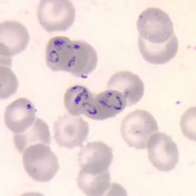 babesia | Parasite, Microbiology, Liver fluke