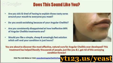 Yeast Infection Treatment Pill - Vaginal Yeast Infection: 6 Natural Ways to Get Rid of It ...