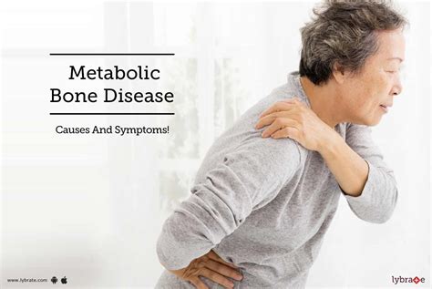 Metabolic Bone Disease - Causes And Symptoms! - By Dr. Radhakrishnan Paulraj | Lybrate