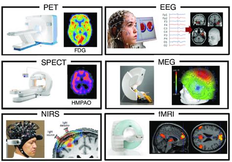 12: Overview of the most common non-invasive functional neuroimaging... | Download Scientific ...