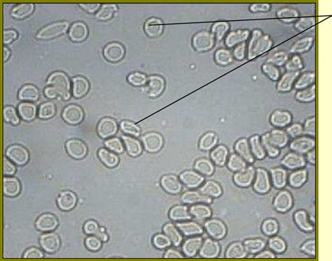 Mammalian red blood cells light microscope x100 | Download Scientific Diagram