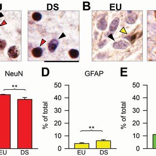 Anatomy of the subiculum in neonate mice. A–D. Nissl‐stained coronal... | Download Scientific ...