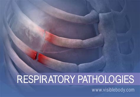 Respiratory Diseases and Disorders | Respiratory Anatomy