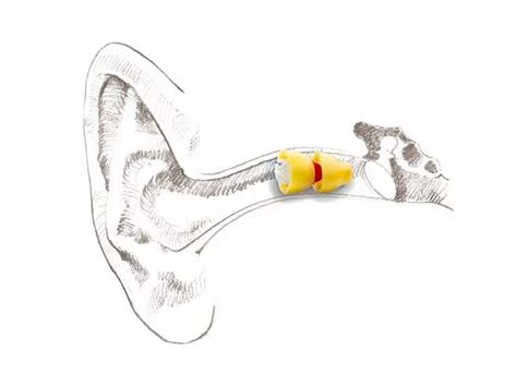 Invisible Hearing Aids | Click Hearing