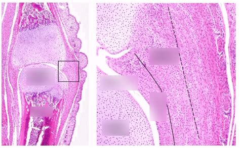 Synovial joint Histology Diagram | Quizlet