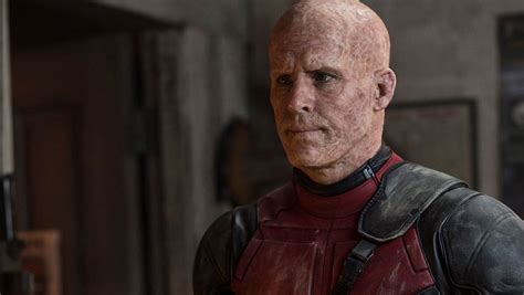 Deadpool: Why Wade Wilson can't heal his deformed skin, Explained