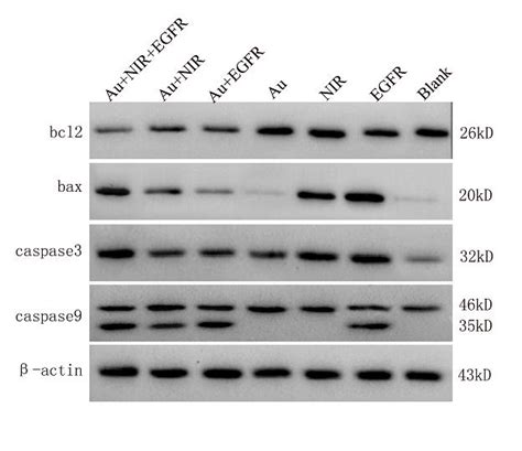 Western blot analysis technique in detecting protein expression level | Medicilon