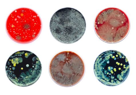 Your Economy is a Petri Dish: Culture It. | Global Innovation Policy Center