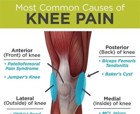 Knee Pain: Common causes of knee pain