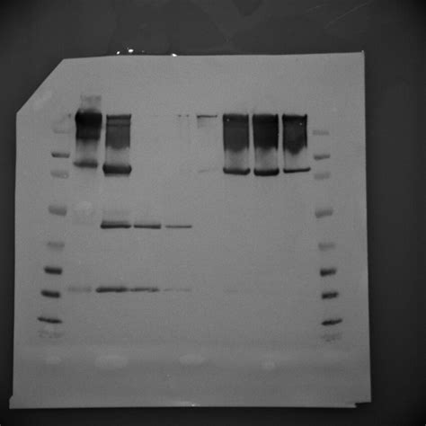 1043 questions with answers in WESTERN BLOT ANALYSIS | Scientific method