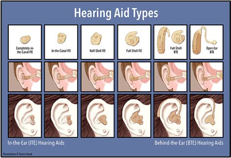 How to Select the Right Hearing Aid - Twin Cities Consumers' Checkbook