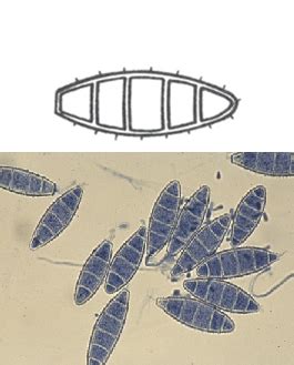 Mycology - macroconidia and microconidia Flashcards | Quizlet