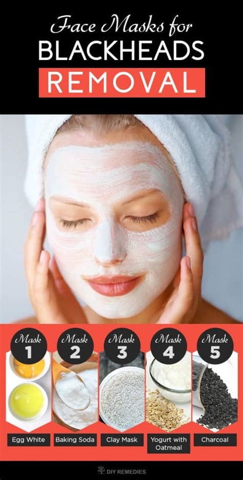 5 Best Face Masks for Blackheads Removal